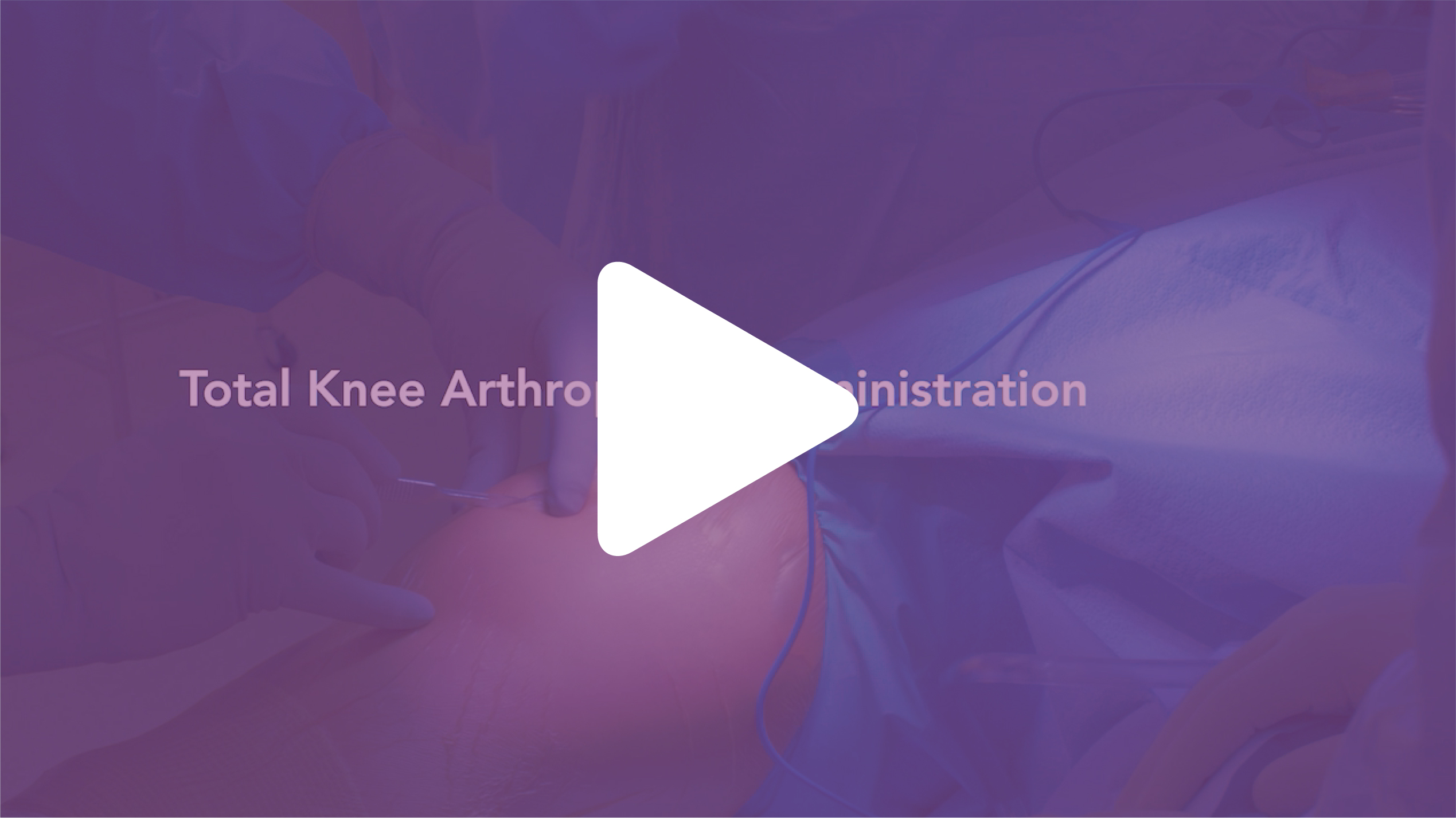 Play video for Total Knee Arthroplasty